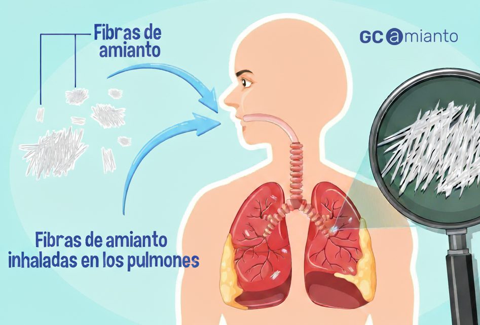 Amianto: qué es, efectos en la salud y cómo actuar en Catalunya